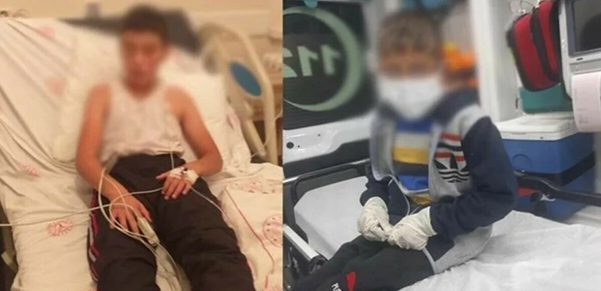 Kuduz olan çocuk yoğun bakımda: 'Durumu ciddi, sudan korkuyor'