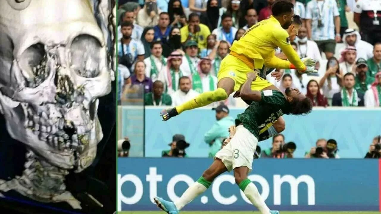 Suudi futbolcu Yasser Al-Shahrani turnuvayı kapattı