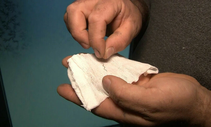 İstanbul'daki bir fırından aldığı ekmeği yerken ölümden döndü! Tomografi sonucunu gördükten sonra hayatının şokunu yaşadı