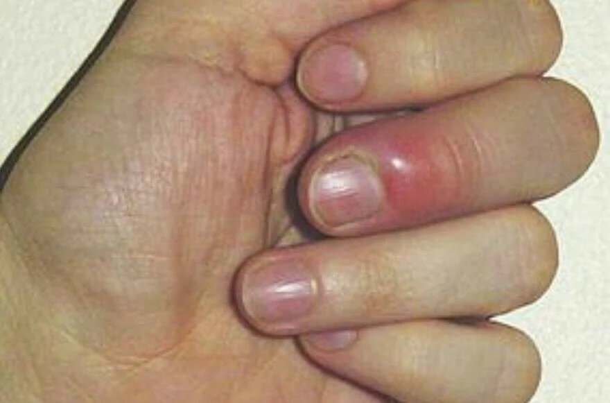 Tırnaktaki şekil ve renk bozuklukları ne anlatır? Sağlıklı tırnak nasıl olmalı?