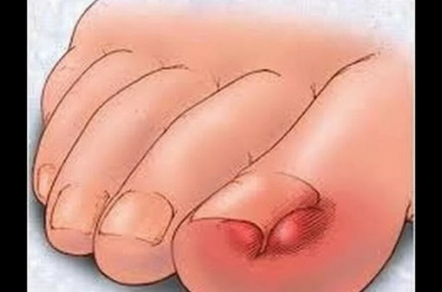 Tırnaktaki şekil ve renk bozuklukları ne anlatır? Sağlıklı tırnak nasıl olmalı?