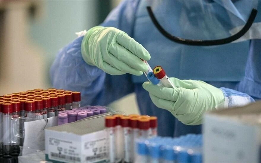 Yeni bir kabus daha! 50 ülkede görülen yeni virüs, Kovid-19 türlerine karşı direniyor