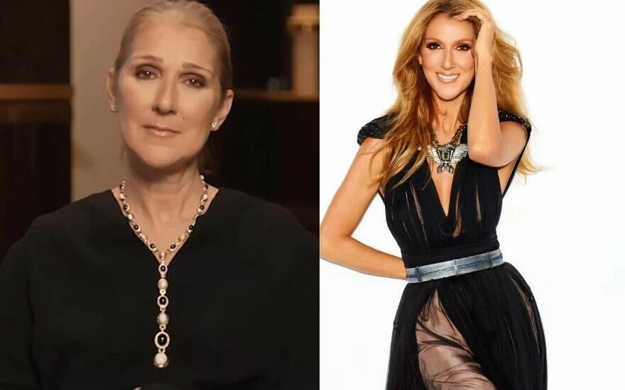 Celine Dion’dan üzen haber: Milyonda bir görülen ve tedavisi olmayan bir hastalığa yakalandığını duyurdu!