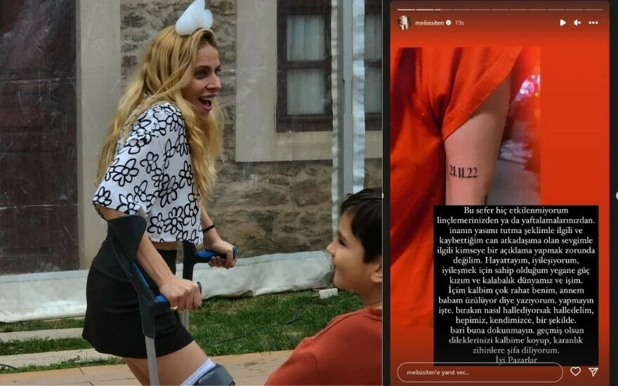 Ölümden dönen Melis İşiten, kaza tarihini koluna kazıdı: “Hiç etkilenmiyorum linçlemelerinizden ya da yaftalamalarınızdan”