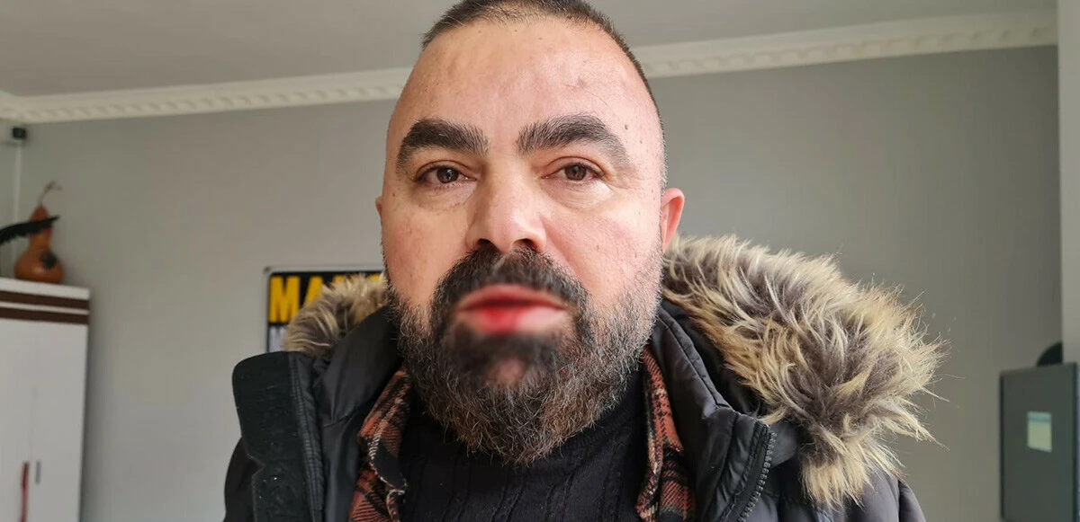 CHP’li yöneticiden gazeteciye yumruklu saldırı