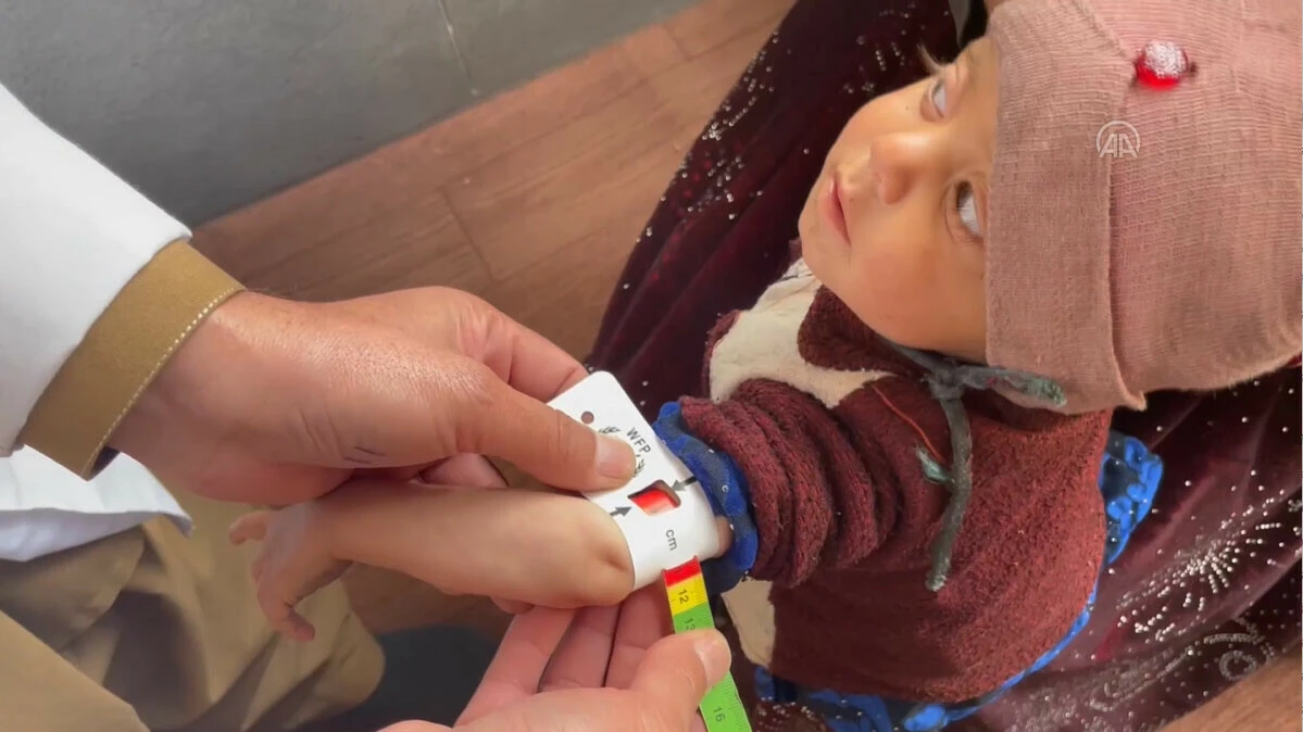 Dünyadaki ilk yıllarında açlıkla boğuşuyorlar, her ay yaklaşık 10 çocuk ölüyor! Afganistan'da acılı anneler anlattı