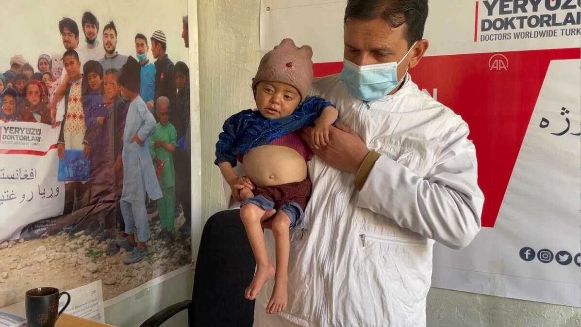 Dünyadaki ilk yıllarında açlıkla boğuşuyorlar, her ay yaklaşık 10 çocuk ölüyor! Afganistan'da acılı anneler anlattı