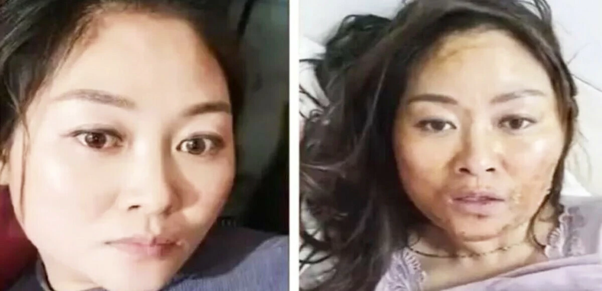 Çin'de yeni semptomlar ortaya çıktı! Mutasyona mı uğradı?