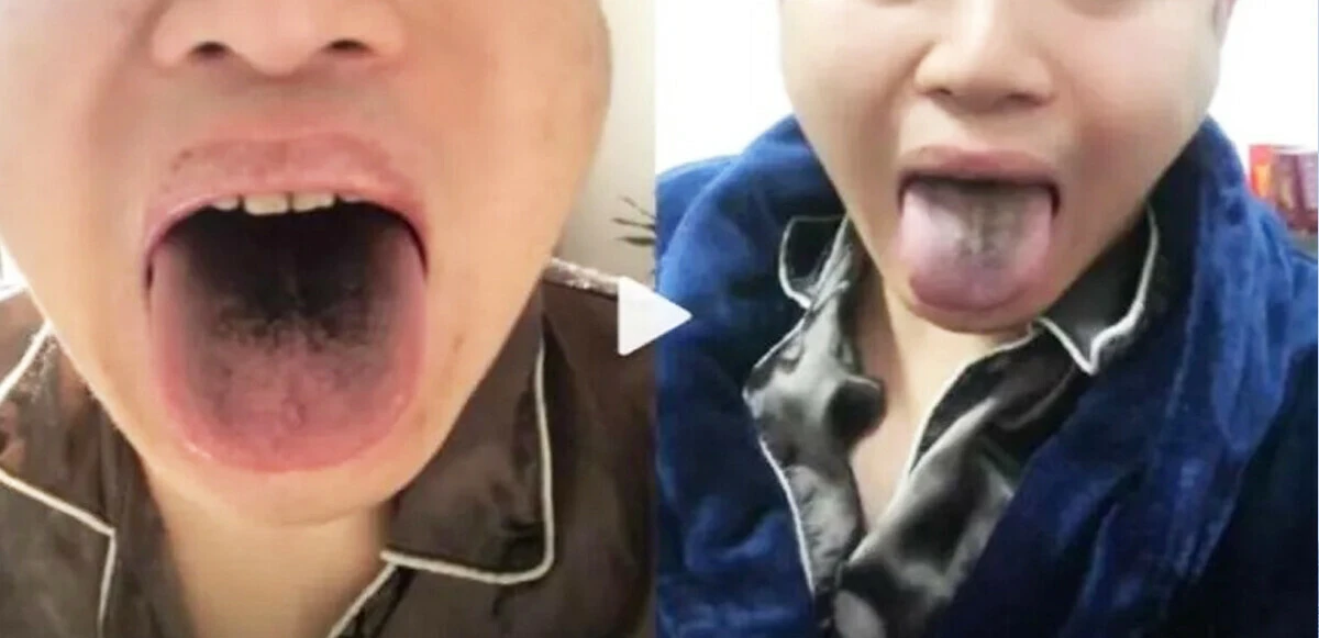 Çin'de yeni semptomlar ortaya çıktı! Mutasyona mı uğradı?